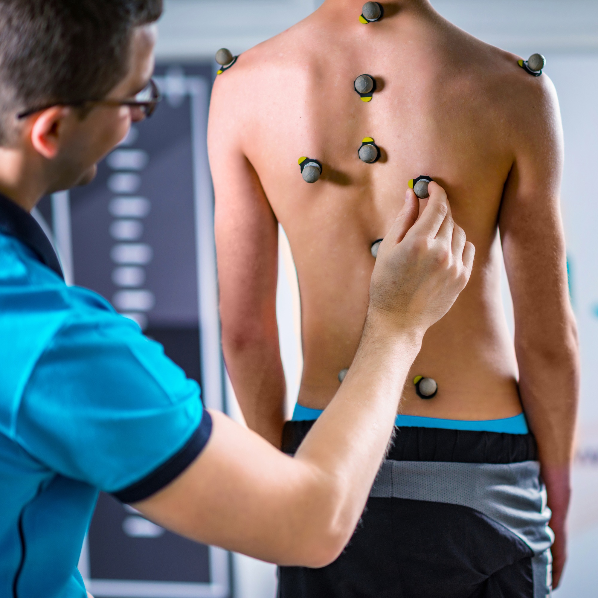 Disfunzione posturale – valutazione clinica con sensori per prevenzione e diagnosi